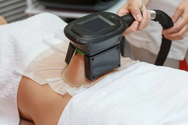 Image of person having fat freezing treatment to help weight gain Buckingham