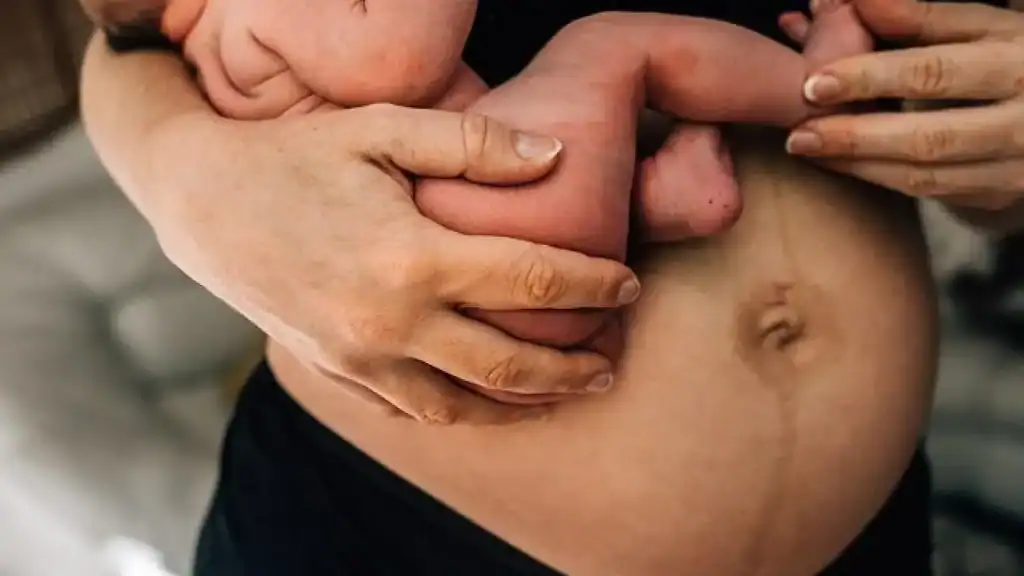 Why Is My Stomach Still Big After Pregnancy Buckingham?